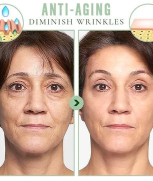 5 in 1 Multifunctional Skin Tightening Facial Massager